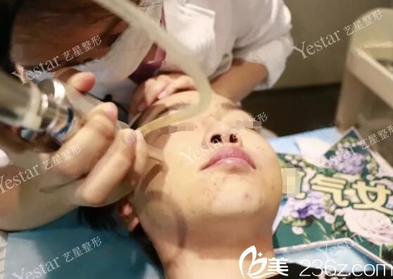 點(diǎn)陣激光祛痘過(guò)程中 點(diǎn)陣激光祛痘過(guò)程中