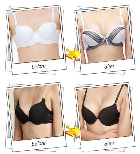 常州曙光隆胸對比照 常州曙光隆胸對比照