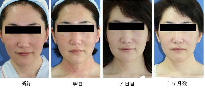 金線美容術(shù)1 金線美容術(shù)1