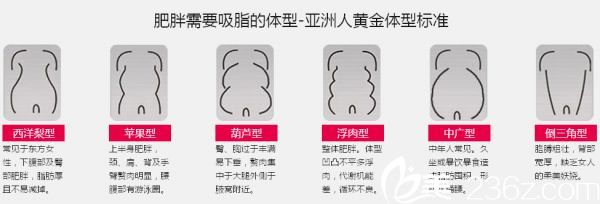 肥胖體型 肥胖體型