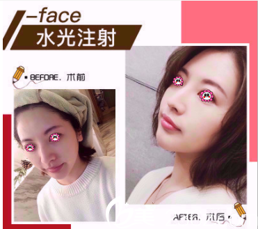 北京玲瓏梵宮多少錢(qián)？德瑪莎價(jià)格199元起及高春紅案例公布