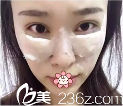 畢勝主任給我做手術(shù)的當天 畢勝主任給我做手術(shù)的當天