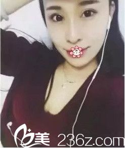 畢勝祛眼袋術(shù)后半個月 畢勝祛眼袋術(shù)后半個月