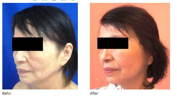 廣島整形醫(yī)院 <span style= 廣島整形醫(yī)院 <span style=