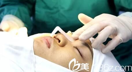 鼻整形術(shù)前設(shè)計(jì) 鼻整形術(shù)前設(shè)計(jì)