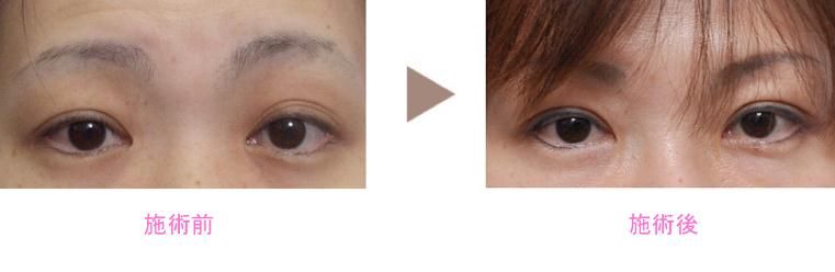 新垣形成外科醫(yī)院 新垣形成外科醫(yī)院