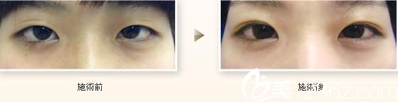 日本 TIARA 整形外科醫(yī)院 日本 TIARA 整形外科醫(yī)院