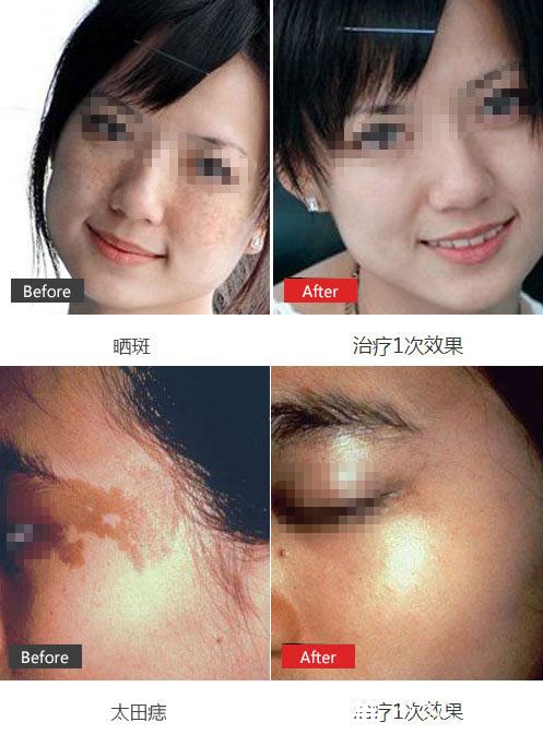 臺州維多利亞魏萍祛斑<span style= 臺州維多利亞魏萍祛斑<span style=