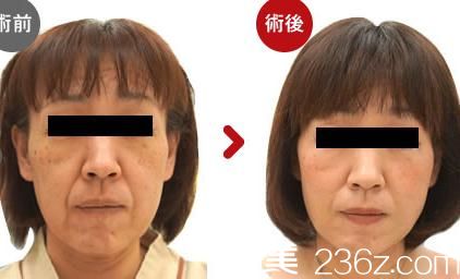 川崎整形醫(yī)院<span style= 川崎整形醫(yī)院<span style=