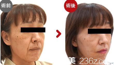 川崎整形醫(yī)院<span style= 川崎整形醫(yī)院<span style=