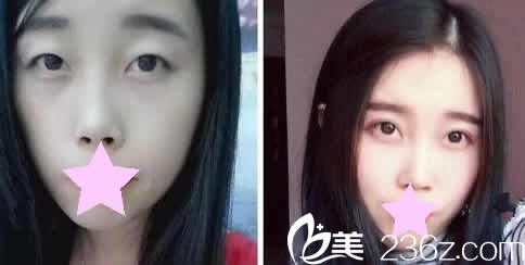 大同打瘦臉多少錢？大同逆時(shí)光整形2018下半年價(jià)格表?yè)屜瓤? width=