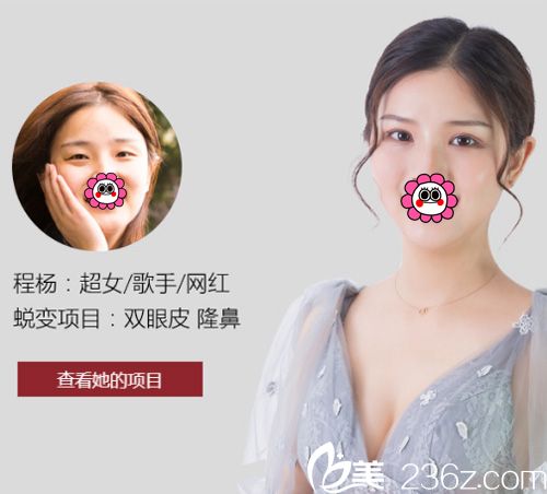 武漢藝星雙眼皮案例