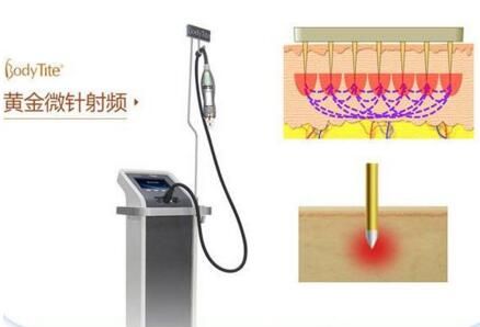 沈陽(yáng)杏林黃金微針射頻醫(yī)療儀器