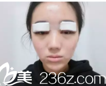 我是順便做了清痘和眼睛項(xiàng)目