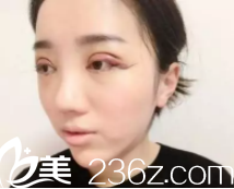 大家不要看我這么腫，每個(gè)人都不一樣