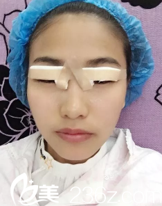 不知道眼睛上貼的是不是創(chuàng)可貼