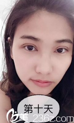 看我假大寬的雙眼皮哈哈