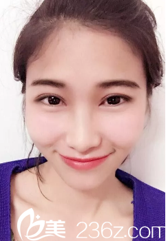 三個(gè)月了，終于恢復(fù)的差不多了