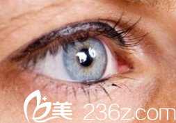 淚小點(diǎn)外翻