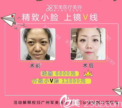 廣州軍美王世虎線雕案例和收費(fèi)價(jià)格 廣州軍美王世虎線雕案例和收費(fèi)價(jià)格