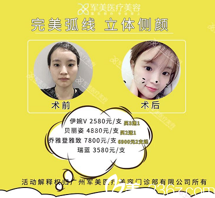 廣州軍美玻尿酸填充案例和優(yōu)惠價(jià)格 廣州軍美玻尿酸填充案例和優(yōu)惠價(jià)格