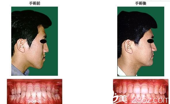 鶴木<!--<i data=20240703-sp></i>-->歯科醫(yī)院鄂變形治療 鶴木<!--<i data=20240703-sp></i>-->歯科醫(yī)院鄂變形治療