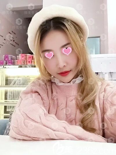 隆胸手術(shù)模特小欣 隆胸手術(shù)模特小欣