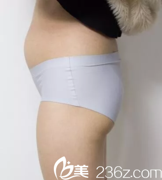 在北京雅靚做水動(dòng)力腰腹吸脂前樣子 在北京雅靚做水動(dòng)力腰腹吸脂前樣子