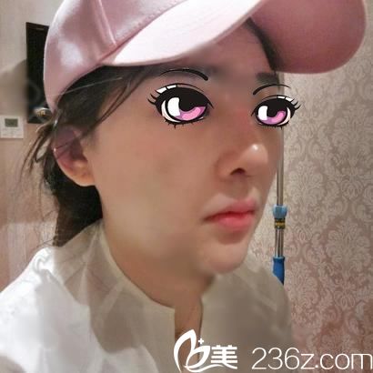 寧波尚麗鼻綜合7天圖 寧波尚麗鼻綜合7天圖