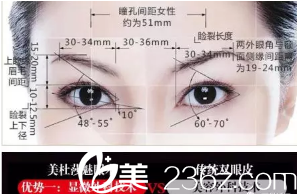 眼睛整形示意圖