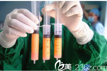 廣州壹加壹脂肪填充 廣州壹加壹脂肪填充