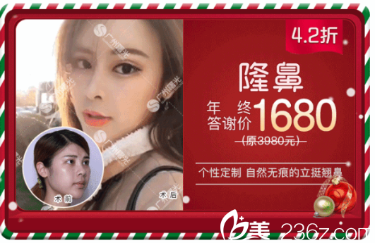 廣州曙光蔣思軍隆鼻1680元附案例