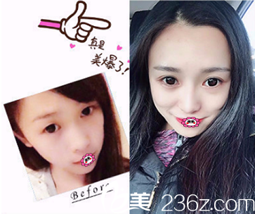 湛美整形醫(yī)院樊濤<span style=