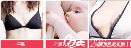 胸部不美觀的因素