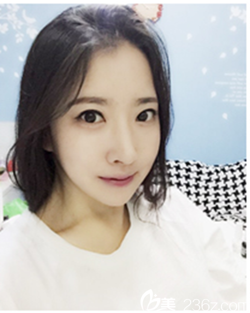 丑女無敵找韓國新帝瑞娜醫(yī)院做眼部+鼻部+脂肪填充+v-line6個月后的大逆襲