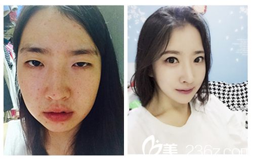 對比  無水印.jpg