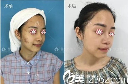 昆明夢(mèng)想祛斑怎么樣？