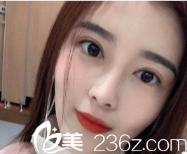 這是的第1211個雙眼皮修復(fù)案例，她曾經(jīng)做過三次眼部手術(shù)