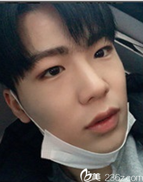 萬般無奈下到韓國灰姑娘膽戰(zhàn)心驚的做了鼻部+眼睛矯正，結(jié)果讓其他人傷心了