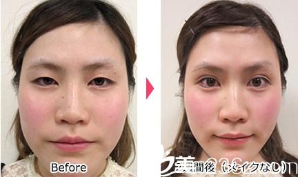 前后對比展示 前后對比展示