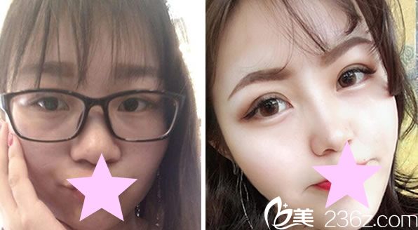 都鎮(zhèn)雨做面部<span style=