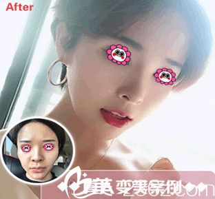 鵬愛整形醫(yī)院變化圖