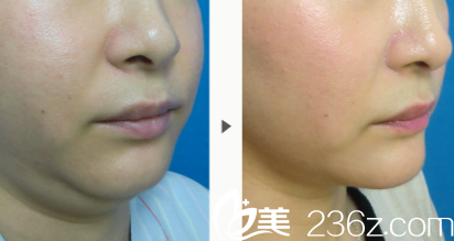 長大庭英信回春駐顏術(shù) 長大庭英信回春駐顏術(shù)