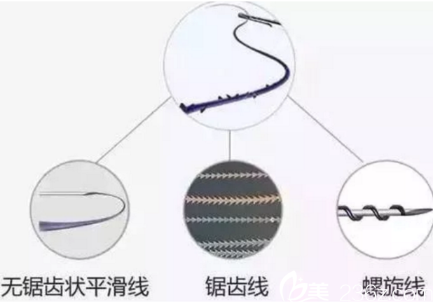 長(zhǎng)春東方面部線雕提升線材分類 長(zhǎng)春東方面部線雕提升線材分類