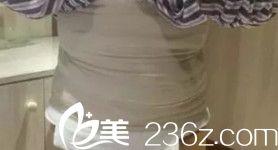 楊輝醫(yī)生為我剛做完腰腹吸脂術后有腫脹感 楊輝醫(yī)生為我剛做完腰腹吸脂術后有腫脹感