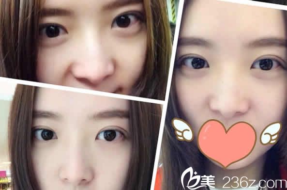 山西整形外科醫(yī)院2019跨年價(jià)格表上線啦 附下頜角整形及耳再造案例