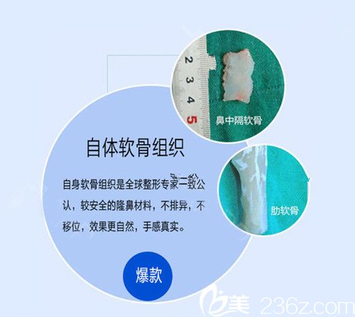 自體軟骨組織 自體軟骨組織