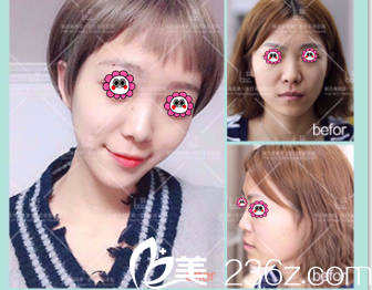 北京聯(lián)合麗格醫(yī)院價(jià)格表公布！伊婉C玻尿酸980元起，紅藍(lán)光祛痘399元起