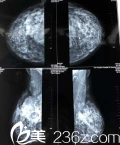 拍片之后的樣子