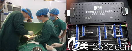 專用自體脂肪填充移植套裝 專用自體脂肪填充移植套裝